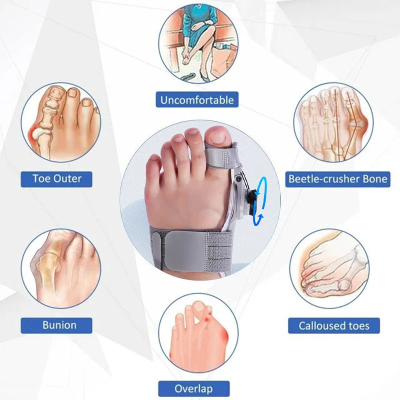 Bunion