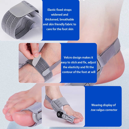 Bunion